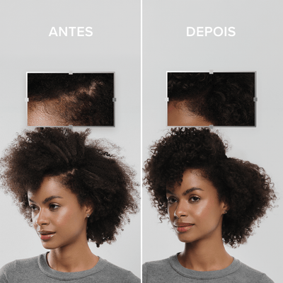 Mulher morena mostrando como seu cabelo era antes e depois de usar os produtos da LinhaAntiqueda UltraResistance. Antes era um cabelo com várias falhas e falta de cabelo. Depois do uso, o cabelo está mais encorpado e preenchido.